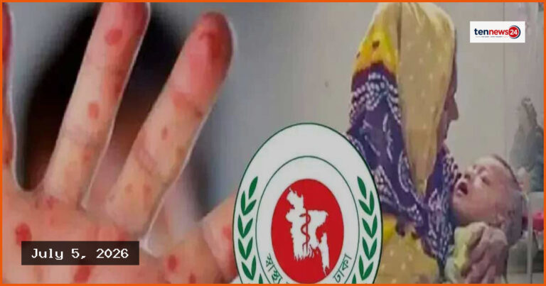 দেশে হাম ও উপসর্গে আরও ৭ শিশুর মৃত্যু