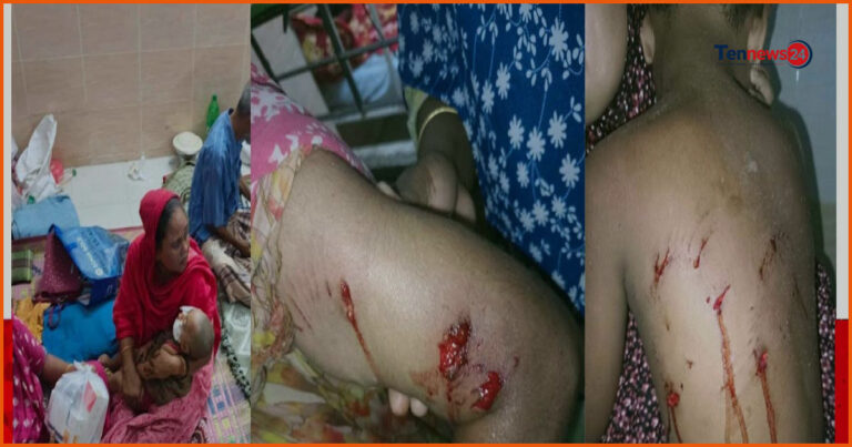 পাবনায় কুকুরের কামড়ে নারী ও শিশুসহ আহত ১১