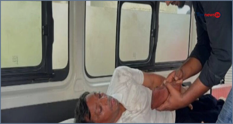 ঘুষ না পেয়ে ঠিকাদারের হাত ভাঙার অভিযোগ সরকারি কর্মকর্তার বিরুদ্ধে