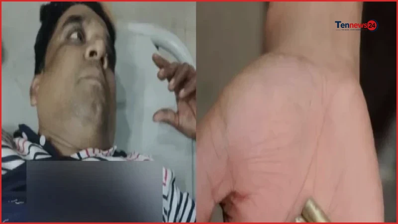 মিরপুরে প্রাইভেট কারে এসে বিএনপি নেতাকে গুলি, পথচারীসহ আহত ২