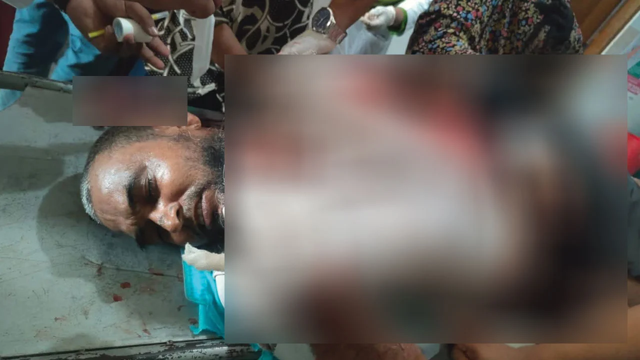 সিরাজগঞ্জে লংমার্চে যাওয়ার পথে জামায়াত নেতাদের ওপর হামলার অভিযোগ