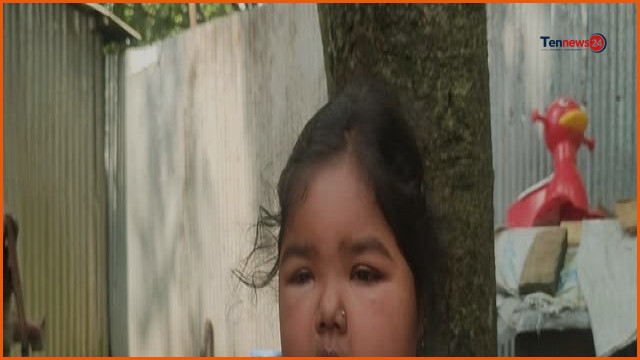কিডনিসহ নানা জটিল রোগে আক্রান্ত বাগাতিপাড়ার জুঁই, সাহায্যের আবেদন