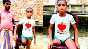 চুল কাটতে গিয়ে নিখোঁজ, ঢাকায় চক্রের হাতে পা হারাল কিশোর রায়হান